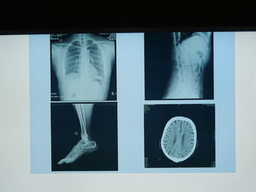 Giá tốt Konida X Ray Phim chụp ảnh y tế không thấm nước cho máy in Agfa trực tuyến