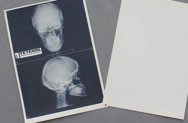 Good price Giấy trắng y tế Ngực X Ray Film Không thấm nước Độ sắc nét cao trực tuyến
