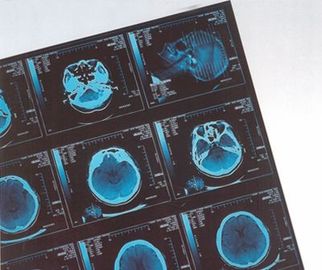 Giá tốt. Kỹ thuật số y tế X Ray Dry Film cho bệnh viện CR / DR trực tuyến