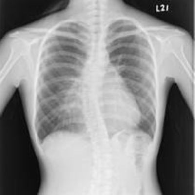 Giá tốt Phim X Ray y tế có thể đeo được, Phim X-quang hình ảnh y tế trực tuyến