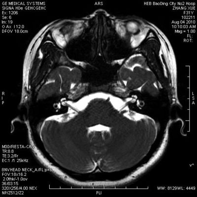 Giá tốt Phim khô Hologpson X Ray không thấm nước KND-A cho máy in nhiệt, AGFA 5300/5500/530 trực tuyến