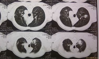 Good price Phim khô y tế thân thiện với môi trường Agfa 2B X Ray với máy CT trực tuyến