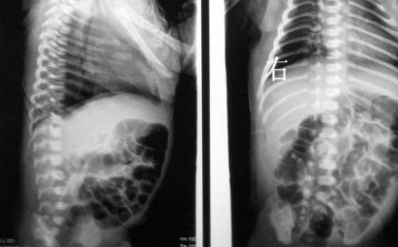 Giá tốt 10 x 14inch Phim X Ray y tế khô cho Fuji 3000/2000/1000 trực tuyến