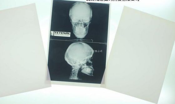 Giá tốt Giấy trắng y tế Xray Giấy xuống cấp cho máy in Laser trực tuyến