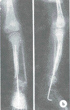 Good price Không thấm nước khô y tế X Ray phim Konida Glossy cho AGFA / Fuji trực tuyến