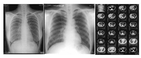 Giá tốt Máy in nhiệt 14 x 17 inch Giai điệu tươi sáng với lớp kép trực tuyến