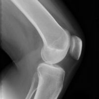 Giá tốt Phim Xray độ sắc nét cao, Phim X quang y tế cho máy in fuji Drypix 2000 trực tuyến