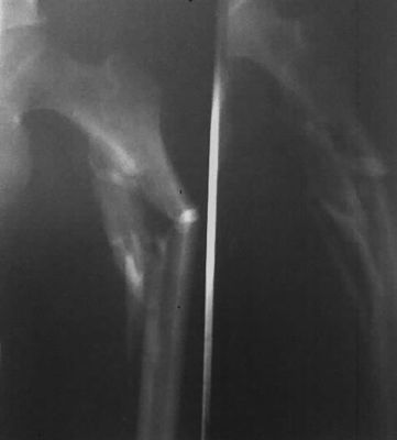 Giá tốt Phim in nhiệt 43cm x 35cm, Phim X-Ray y tế Fuji khô trực tuyến