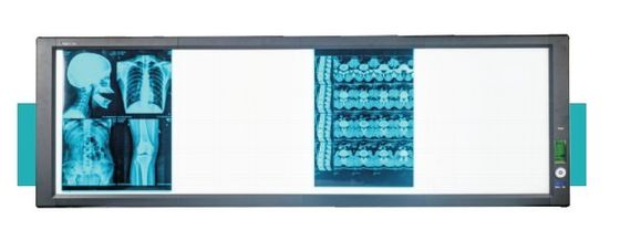 Giá tốt Hộp xem siêu sáng LED y tế trực tuyến