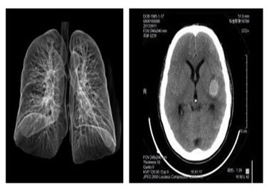 Good price Blue PET Medical X Ray Film 14 x 17in Agfa Dstallar 5503 Dành cho Hosipital trực tuyến