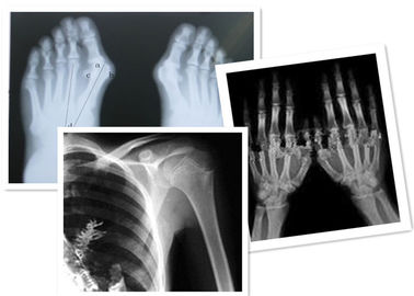Good price Nhiệt kỹ thuật số X Ray Film Fuji y tế để kiểm tra phóng xạ trực tuyến