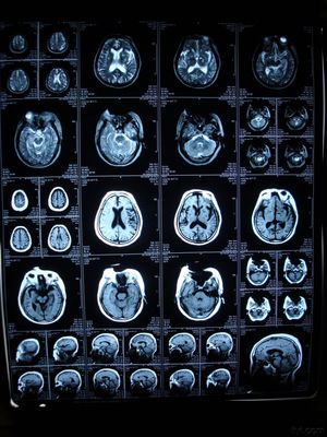 Giá tốt Phim chụp X-quang khô kỹ thuật số y tế tùy chỉnh của Konida dành cho máy in AGFA / Fuji trực tuyến