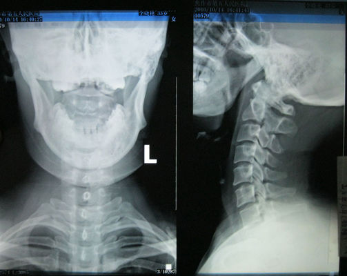 Giá tốt Phim chụp ảnh khô y tế có độ bóng 35cm * 43cm cho máy in nhiệt Fuji 3000, 2000, 1000, trực tuyến