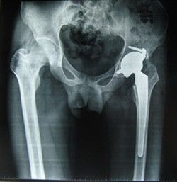 Giá tốt Low Fog Bluish Polyester Base Konida Medical Imaging Film 28cm * 35cm cho máy in nhiệt trực tuyến