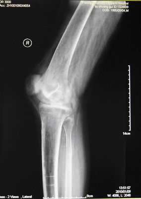 Giá tốt Phim chụp ảnh khô y tế độ sắc nét cao KND-A cho AGFA 5300, 5302, 5500, 5502, 3000 trực tuyến