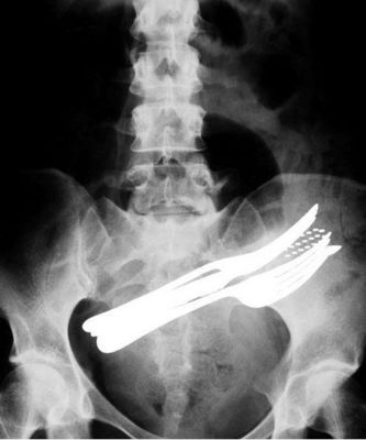 Giá tốt Phim chụp ảnh y tế khô 11in x 14in trong suốt KND-A cho AGFA trực tuyến