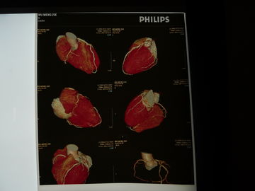 Good price Phim chụp ảnh khô y tế 35cm x 43cm, phim X-quang ngực minh bạch trực tuyến