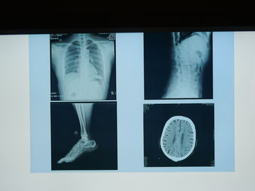 Konida X Ray Phim chụp ảnh y tế không thấm nước cho máy in Agfa