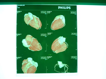 Good price Phim khô kỹ thuật số y tế X Ray, phim chụp ảnh khô y tế Dt2b / Dt1b Agfa trực tuyến