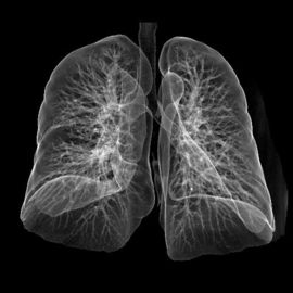 Good price Laser sắc nét y tế X-Ray Film Konida cho CT / DR trực tuyến