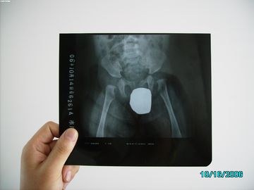 Good price Bạc Halide Laser X Ray Y tế Hình ảnh chống nước mỏng Agfa DRYSTAR DT1B / DT2B trực tuyến