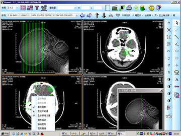 8 x 10inch Giấy y tế Chẩn đoán hình ảnh Laser X Ray cho KND-DRYTEC 4000
