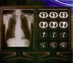 Phim Clear Ray Digital X Ray, Phim minh bạch Laser y tế Konida