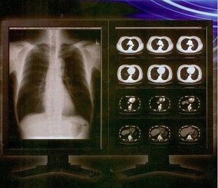 Good price Phim Clear Ray Digital X Ray, Phim minh bạch Laser y tế Konida trực tuyến