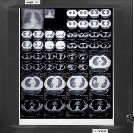 Phim X Ray y tế có thể đeo được, Phim X-quang hình ảnh y tế