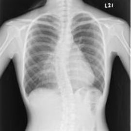 Good price Phim X Ray y tế có thể đeo được, Phim X-quang hình ảnh y tế trực tuyến