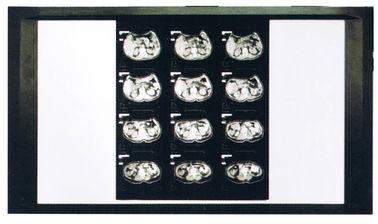 Chẩn đoán Laser X Ray Film y tế cho máy in AGFA / Fuji