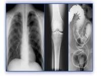 Good price Phim ảnh ba chiều y học, máy in nhiệt PET X Ray Film trực tuyến