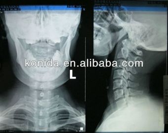 Good price Hình ảnh chẩn đoán y tế sắc nét cao, phim khô AGFA X Ray trực tuyến