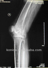 Good price Hình ảnh chẩn đoán X X bền, Phim y tế 32cm x 43cm Laser Blue X Ray trực tuyến
