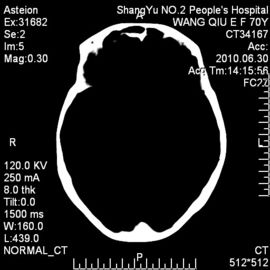 Good price Phim chụp ảnh khô y tế X-ray 10 x 14 Nhiệt nhạy cảm cho máy in Fuji trực tuyến