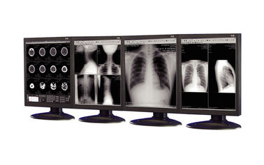 Màn hình y tế chống phản chiếu được sử dụng trong thiết bị hình ảnh y tế