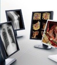 Good price Hình ảnh rõ ràng Hiển thị cấp độ y tế, Màn hình y tế thang màu xám 5MP trực tuyến