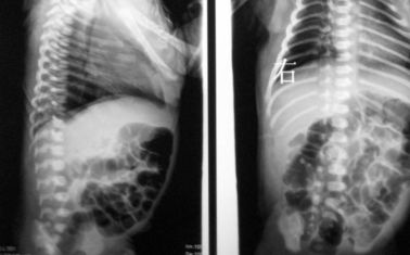 Good price 10 x 14inch Phim X Ray y tế khô cho Fuji 3000/2000/1000 trực tuyến