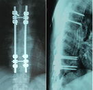 Good price Phim Xray khô 8 x 10 inch y tế hai mặt cho AGFA Dstallar \ trực tuyến