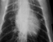 Good price Sương mù thấp 11 x 14 Phim Xray cho máy in Laser y tế KND-K trực tuyến