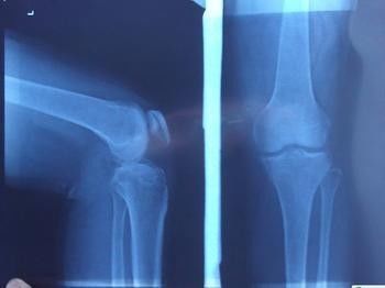 Hình ảnh chẩn đoán Blue X Ray, phim ảnh laser y tế Xray