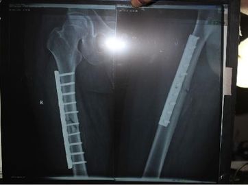 Good price Xray Film y tế thân thiện với môi trường dành cho máy in Laser KND DRYTEC 3000 trực tuyến