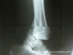 Giấy trắng Laser X Ray Y tế Hình ảnh 8in x 10in Không thấm nước