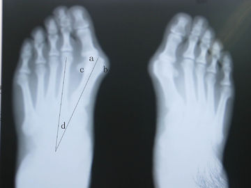 Good price Chẩn đoán hình ảnh X Ray không thấm nước trực tuyến