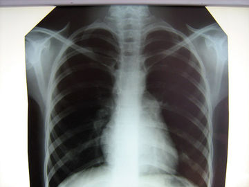 Bệnh viện rõ ràng X-Ray Film Konida với máy in nhiệt