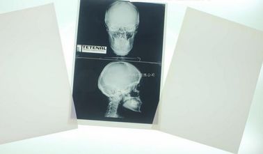 Good price Hình ảnh y tế Konida 10in X 12in X Ray trực tuyến