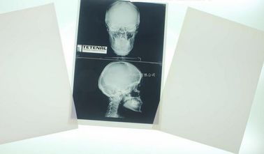 Hình ảnh y tế Konida 10in X 12in X Ray