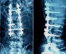 Good price Màu xanh AGFA Medical X Ray Films 10in x 12in, Độ sắc nét cao trực tuyến