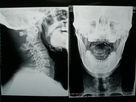 Phim chụp ảnh y tế mật độ cao X Ray khô cho Fuji 3000/2000/1000