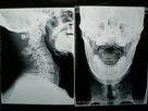 Good price Phim chụp ảnh y tế mật độ cao X Ray khô cho Fuji 3000/2000/1000 trực tuyến